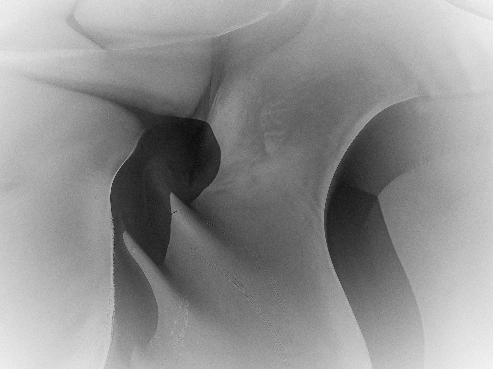 A radiograph of a knee joint