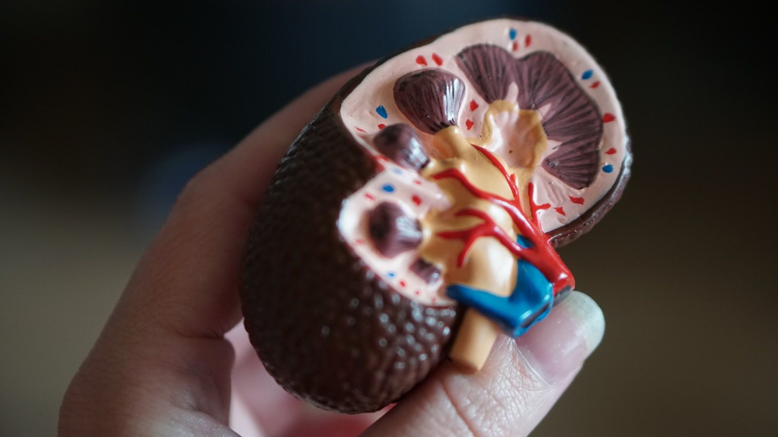 An anatomical model of a kidney