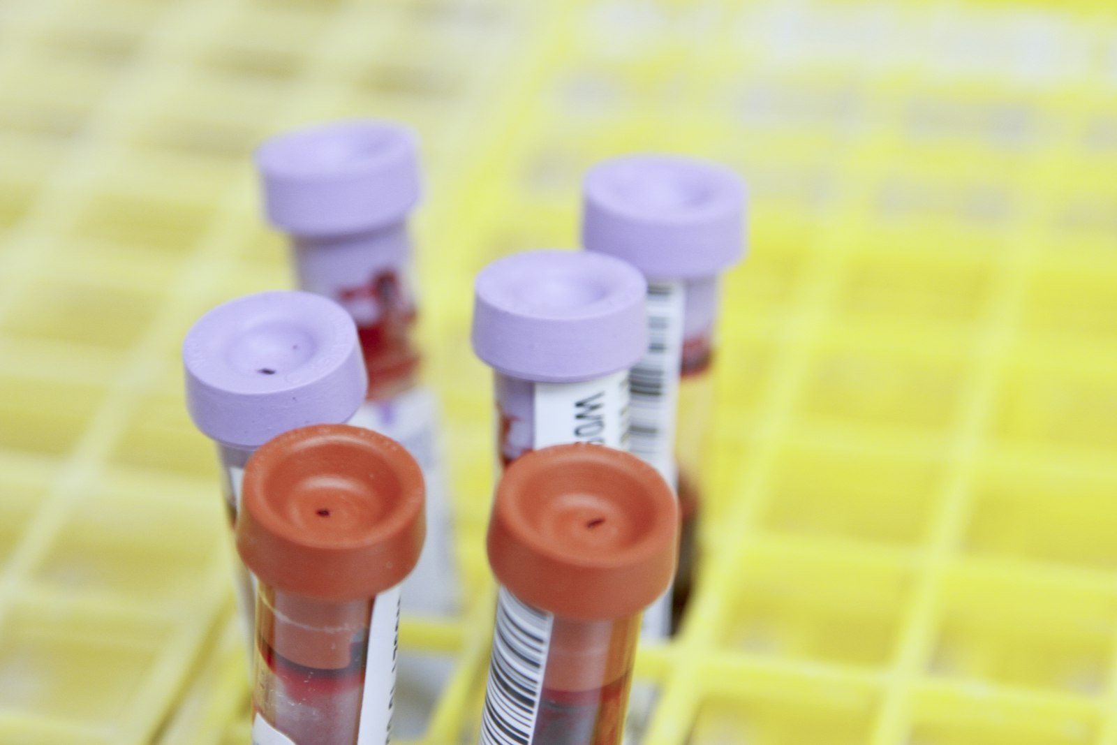 Blood samples being processed for laboratory testing