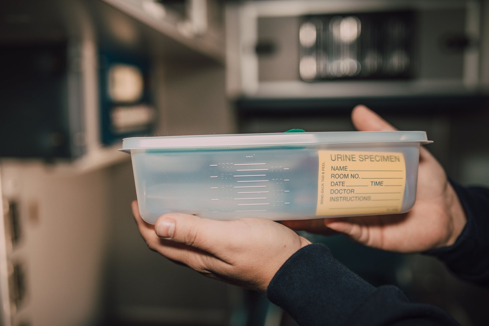 A urine specimen container on a laboratory bench