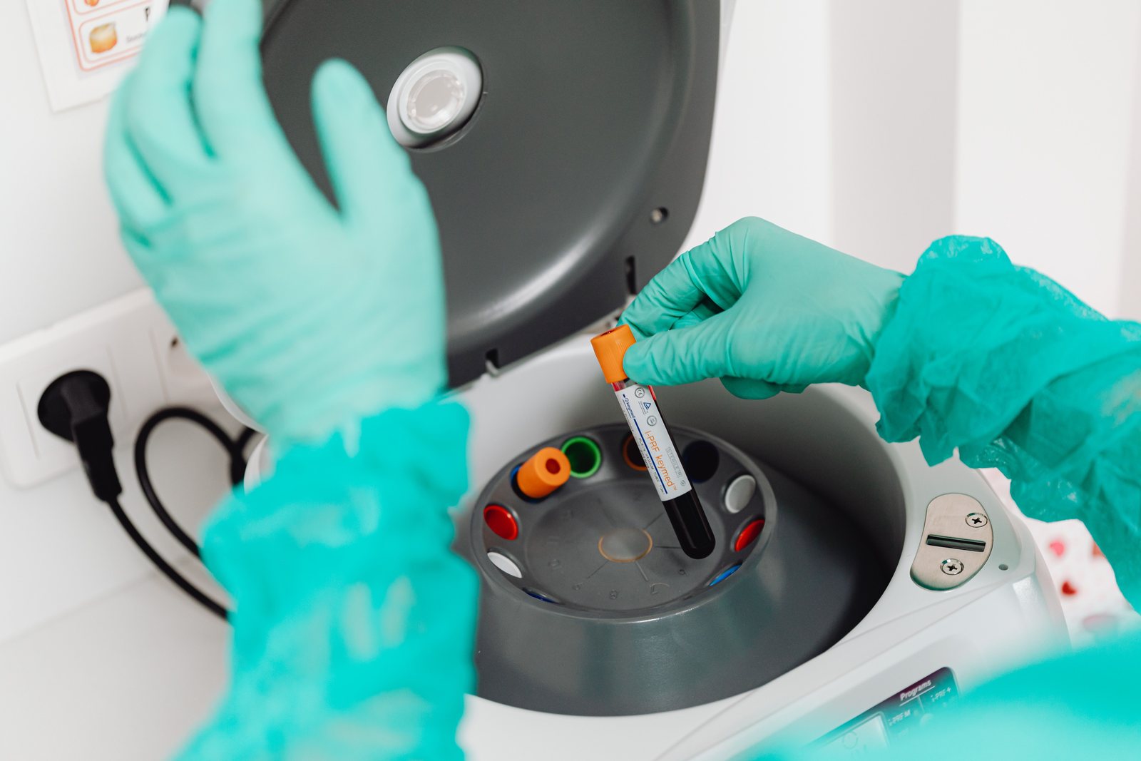 Blood samples being loaded into a laboratory centrifuge