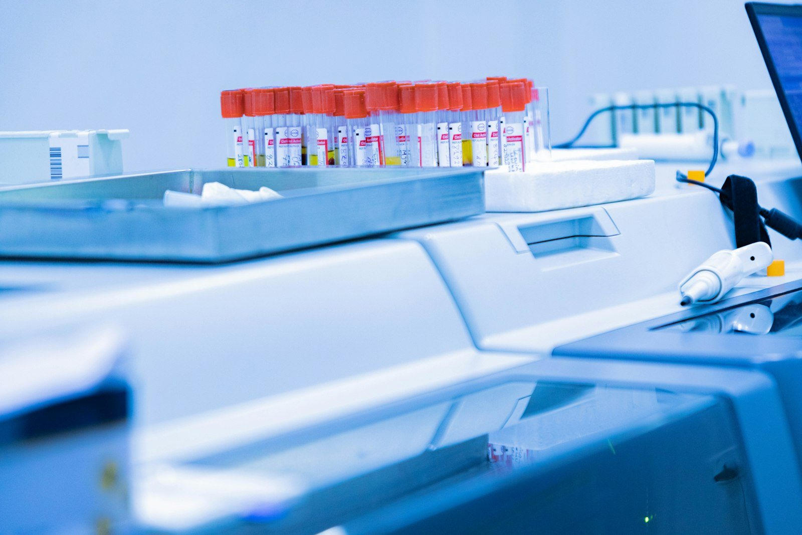 Blood sample tubes ready for laboratory testing