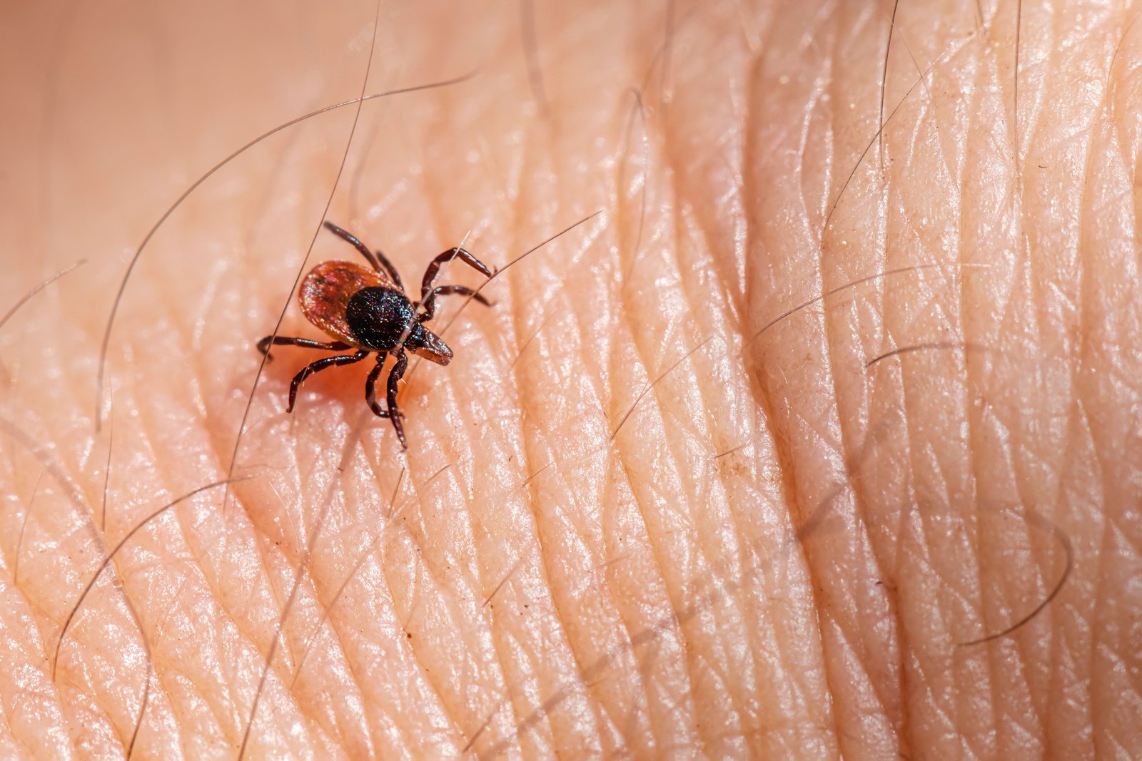 A tick crawling on human skin