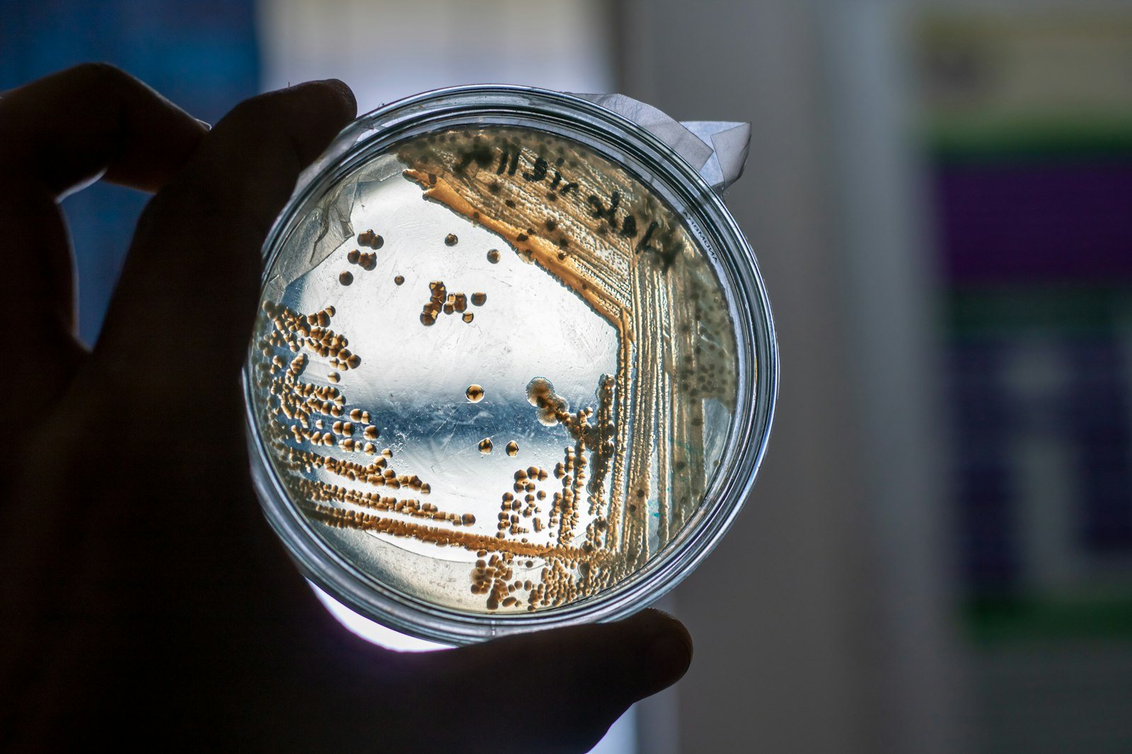 A petri dish holding a bacterial culture