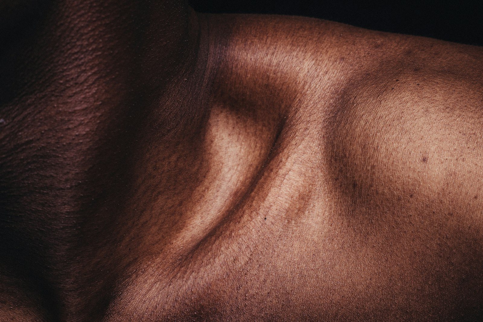 A close view of skin on a forearm