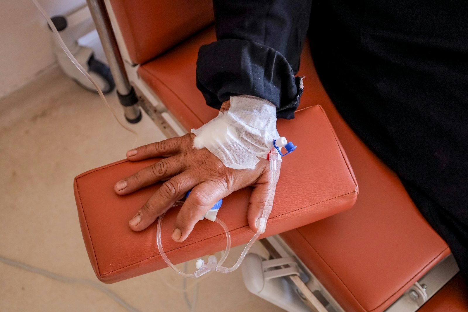 An intravenous line in the hand of a seated patient